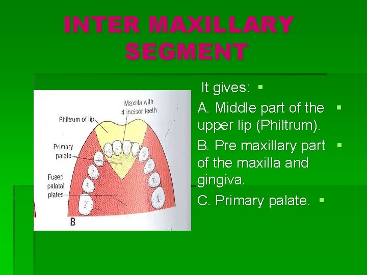 INTER MAXILLARY SEGMENT It gives: § A. Middle part of the § upper lip
