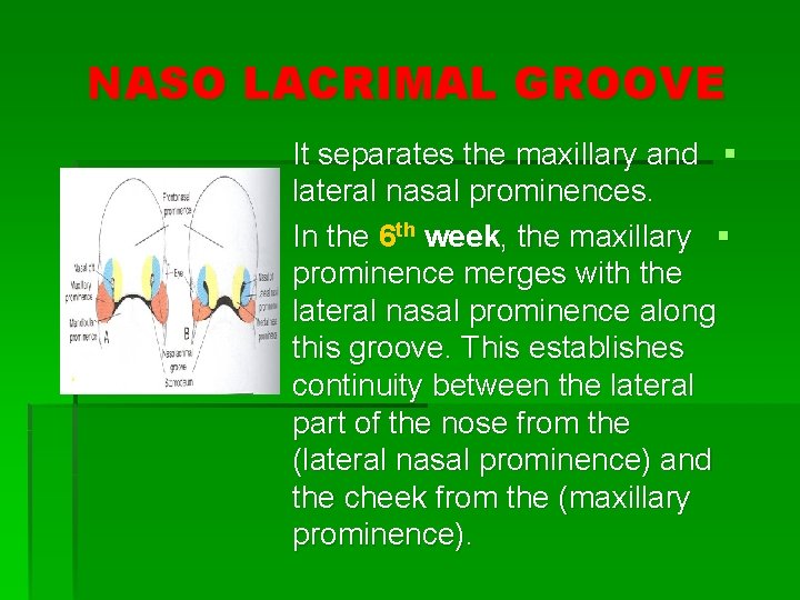 NASO LACRIMAL GROOVE It separates the maxillary and § lateral nasal prominences. In the