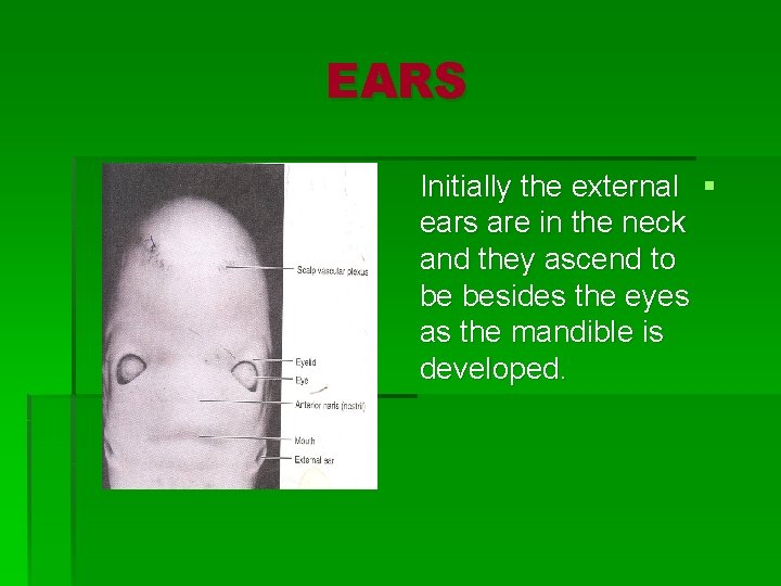 EARS Initially the external § ears are in the neck and they ascend to