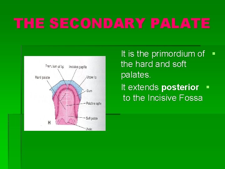 THE SECONDARY PALATE It is the primordium of § the hard and soft palates.