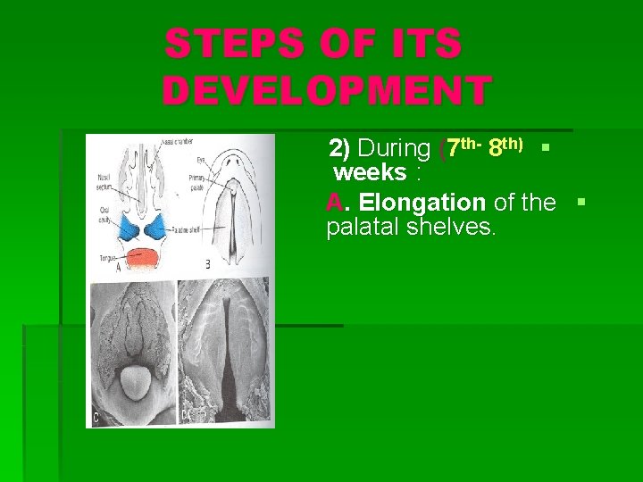 STEPS OF ITS DEVELOPMENT 2) During (7 th- 8 th) § weeks : A.