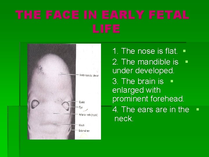 THE FACE IN EARLY FETAL LIFE 1. The nose is flat. § 2. The