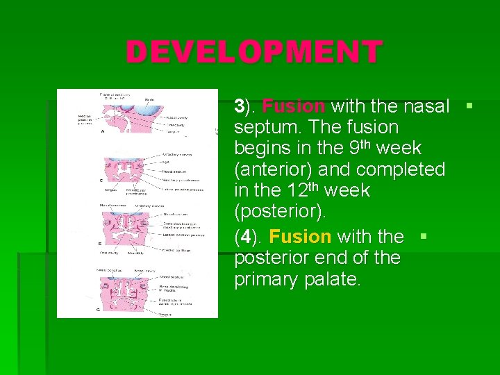 DEVELOPMENT 3). Fusion with the nasal § septum. The fusion begins in the 9