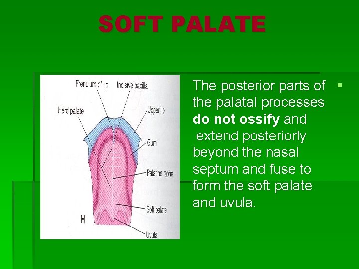 SOFT PALATE The posterior parts of § the palatal processes do not ossify and
