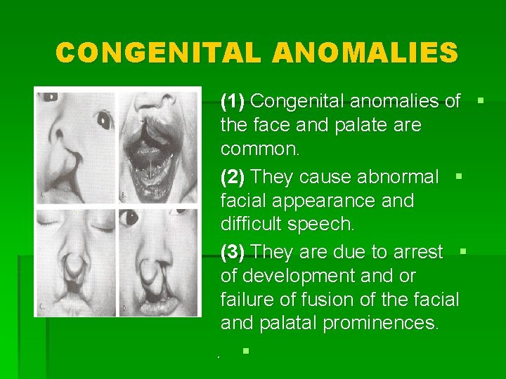 CONGENITAL ANOMALIES (1) Congenital anomalies of § the face and palate are common. (2)