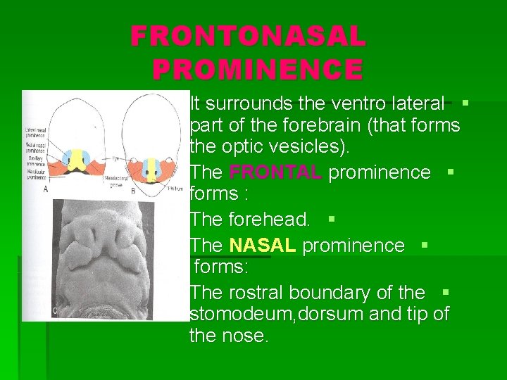FRONTONASAL PROMINENCE It surrounds the ventro lateral § part of the forebrain (that forms