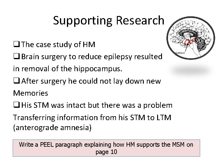 Supporting Research q The case study of HM q Brain surgery to reduce epilepsy
