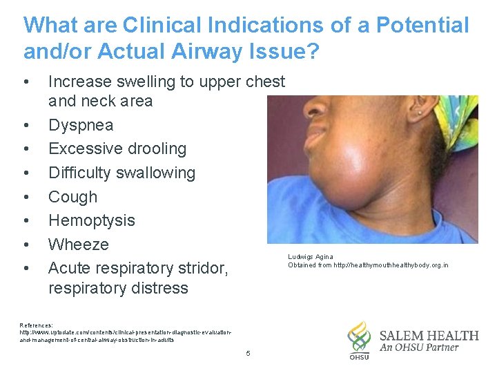 What are Clinical Indications of a Potential and/or Actual Airway Issue? • • Increase