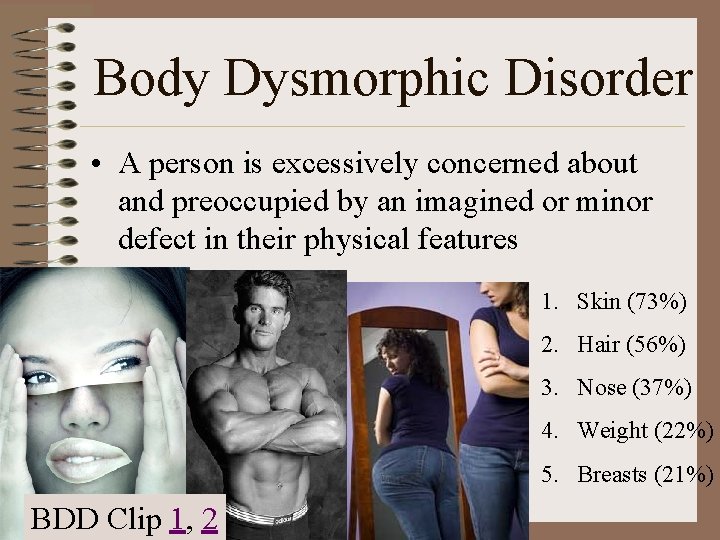 Body Dysmorphic Disorder • A person is excessively concerned about and preoccupied by an