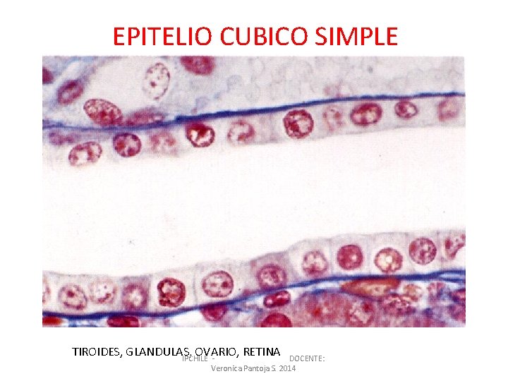EPITELIO CUBICO SIMPLE TIROIDES, GLANDULAS, OVARIO, RETINA IPCHILE - DOCENTE: Veronica Pantoja S. 2014