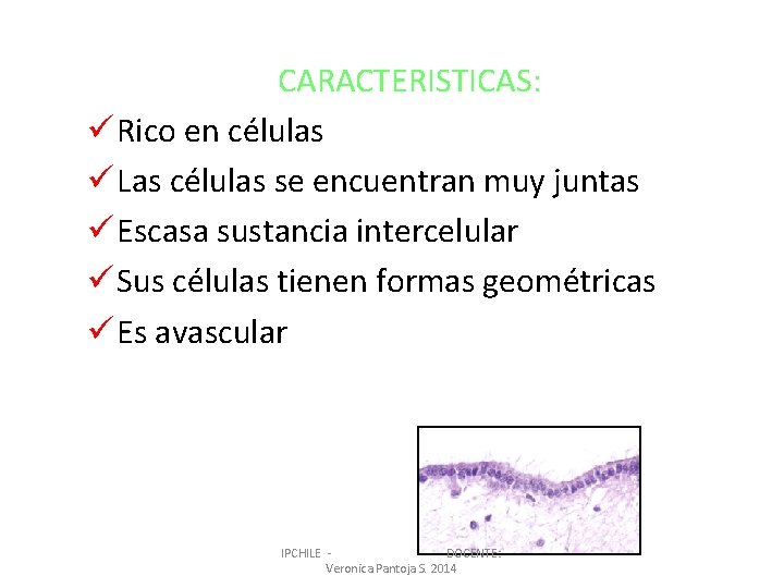 CARACTERISTICAS: ü Rico en células ü Las células se encuentran muy juntas ü Escasa