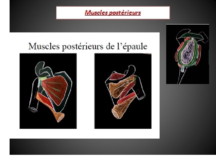 EPAULE DOULOUREUSE Module de rhumatologie Facult de mdecine