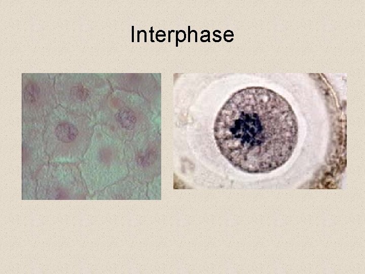 Interphase 