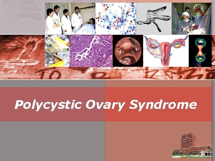 Polycystic Ovary Syndrome 