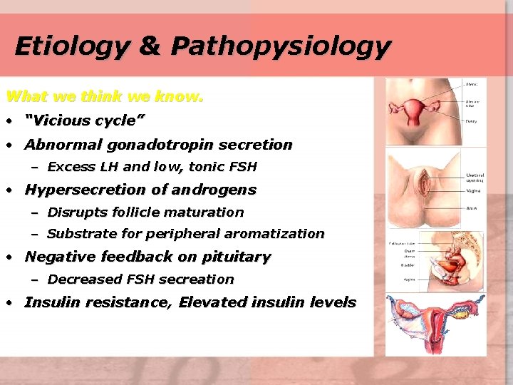 Etiology & Pathopysiology What we think we know. • “Vicious cycle” • Abnormal gonadotropin