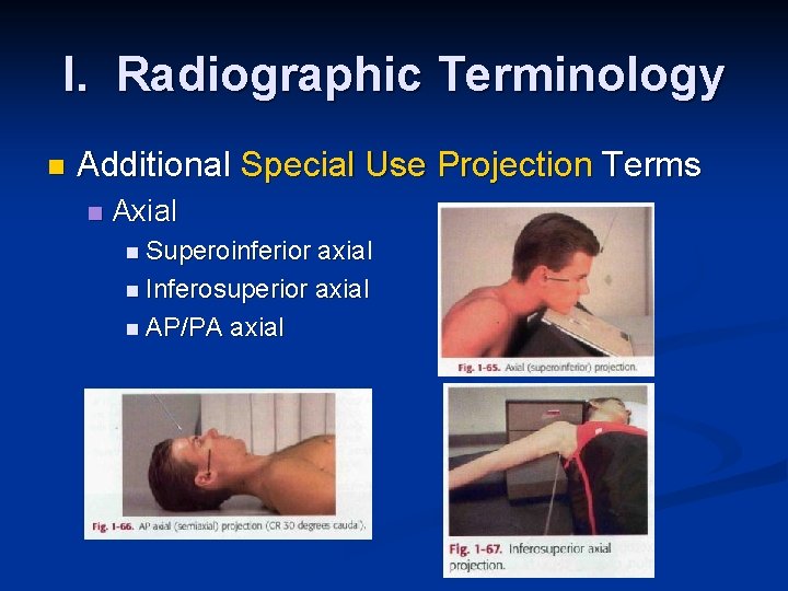 I. Radiographic Terminology n Additional Special Use Projection Terms n Axial n Superoinferior axial