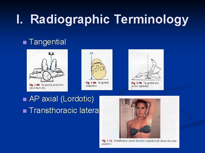 I. Radiographic Terminology n Tangential AP axial (Lordotic) n Transthoracic lateral n 