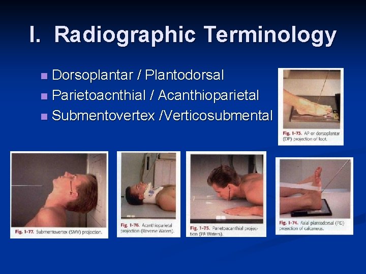 I. Radiographic Terminology Dorsoplantar / Plantodorsal n Parietoacnthial / Acanthioparietal n Submentovertex /Verticosubmental n