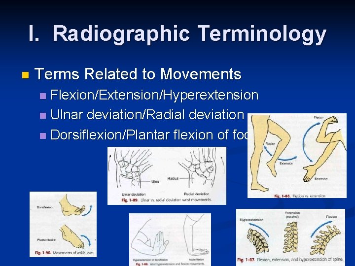 I. Radiographic Terminology n Terms Related to Movements Flexion/Extension/Hyperextension n Ulnar deviation/Radial deviation n
