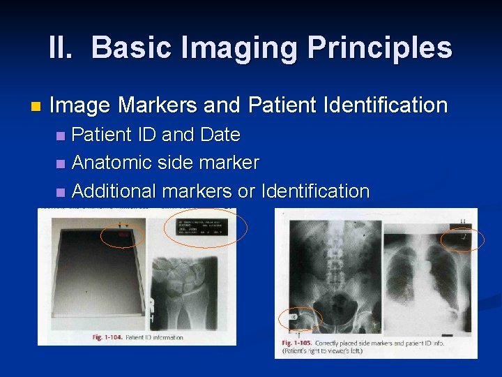 II. Basic Imaging Principles n Image Markers and Patient Identification Patient ID and Date