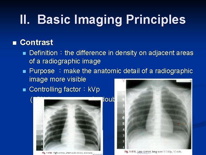 II. Basic Imaging Principles n Contrast n n n Definition：the difference in density on