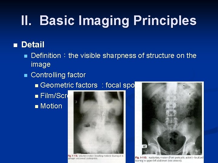 II. Basic Imaging Principles n Detail n n Definition：the visible sharpness of structure on