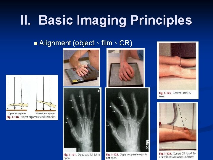 II. Basic Imaging Principles n Alignment (object、film、CR) 