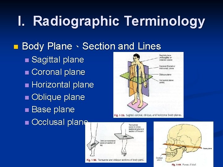 I. Radiographic Terminology n Body Plane、Section and Lines Sagittal plane n Coronal plane n