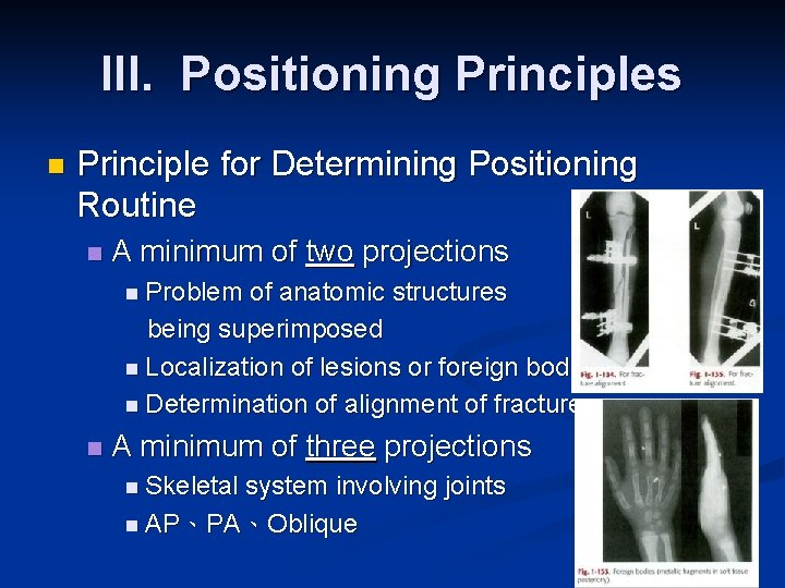 III. Positioning Principles n Principle for Determining Positioning Routine n A minimum of two