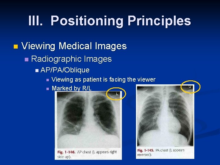 III. Positioning Principles n Viewing Medical Images n Radiographic Images n AP/PA/Oblique n n