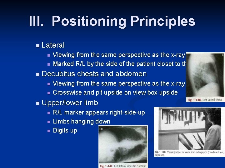 III. Positioning Principles n Lateral n n Viewing from the same perspective as the