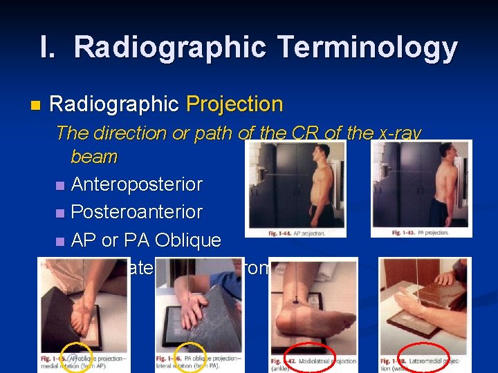 I. Radiographic Terminology n Radiographic Projection The direction or path of the CR of