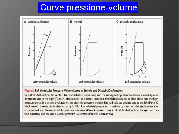 Curve pressione-volume 