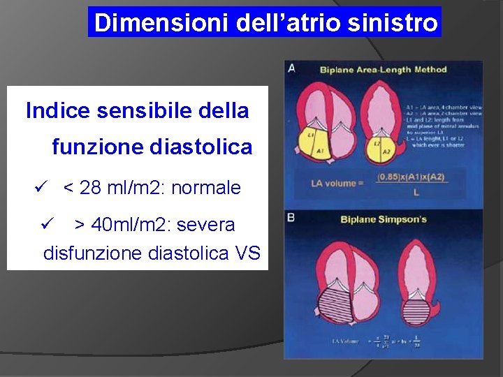 Dimensioni dell’atrio sinistro Indice sensibile della funzione diastolica ü < 28 ml/m 2: normale