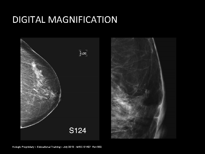 DIGITAL MAGNIFICATION Hologic Proprietary – Educational Training – July 2013 - MISC-01427 Rev 002