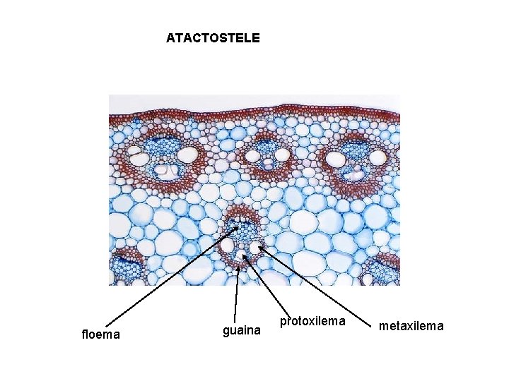 ATACTOSTELE floema guaina protoxilema metaxilema 
