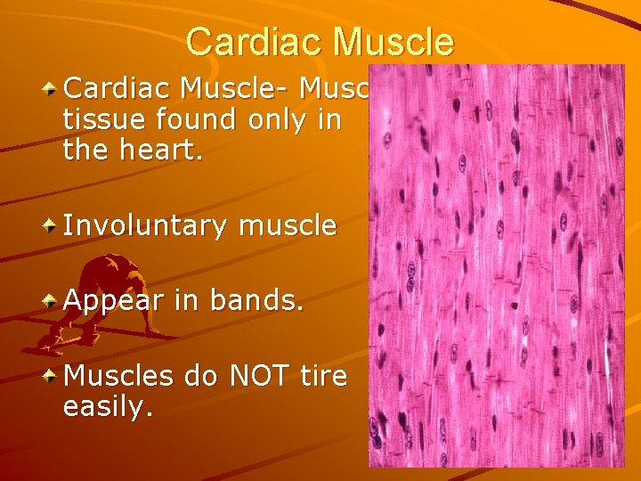 Cardiac Muscle- Muscle tissue found only in the heart. Involuntary muscle Appear in bands.