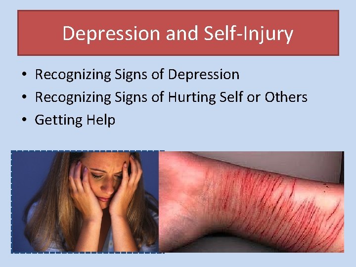 Depression and Self-Injury • Recognizing Signs of Depression • Recognizing Signs of Hurting Self