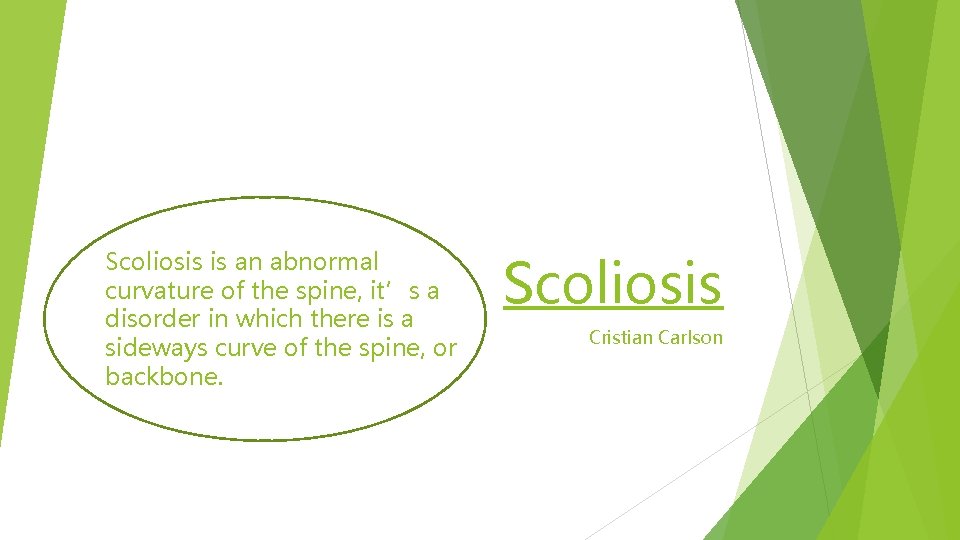 Scoliosis is an abnormal curvature of the spine, it’s a disorder in which there