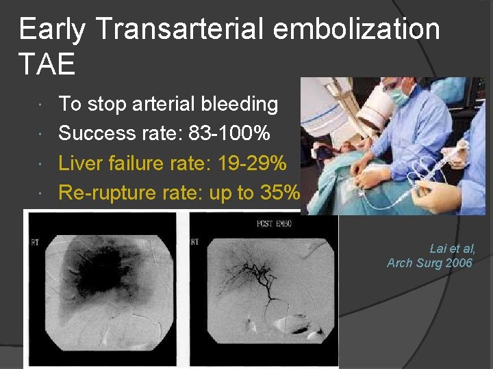 Early Transarterial embolization TAE To stop arterial bleeding Success rate: 83 -100% Liver failure