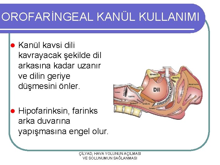 OROFARİNGEAL KANÜL KULLANIMI l Kanül kavsi dili kavrayacak şekilde dil arkasına kadar uzanır ve