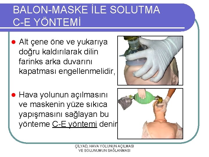 BALON-MASKE İLE SOLUTMA C-E YÖNTEMİ l Alt çene öne ve yukarıya doğru kaldırılarak dilin