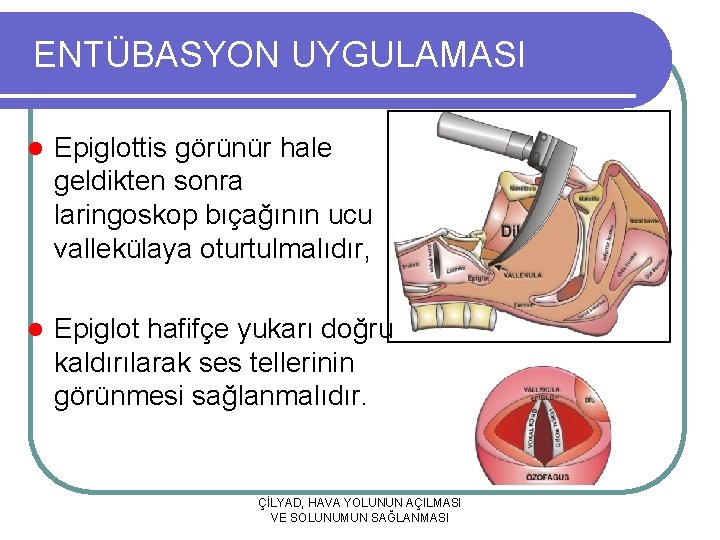 ENTÜBASYON UYGULAMASI l Epiglottis görünür hale geldikten sonra laringoskop bıçağının ucu vallekülaya oturtulmalıdır, l