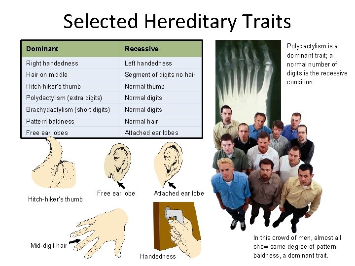Selected Hereditary Traits Dominant Recessive Right handedness Left handedness Hair on middle Segment of