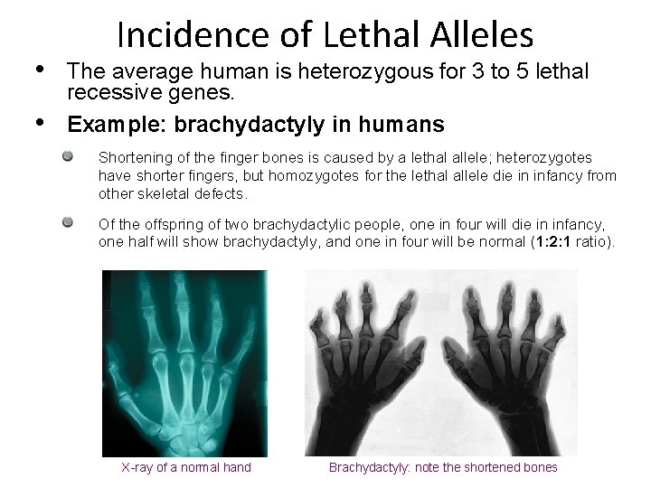  • • Incidence of Lethal Alleles The average human is heterozygous for 3