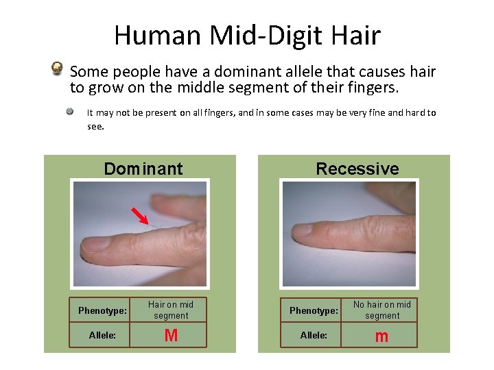Human Mid-Digit Hair Some people have a dominant allele that causes hair to grow