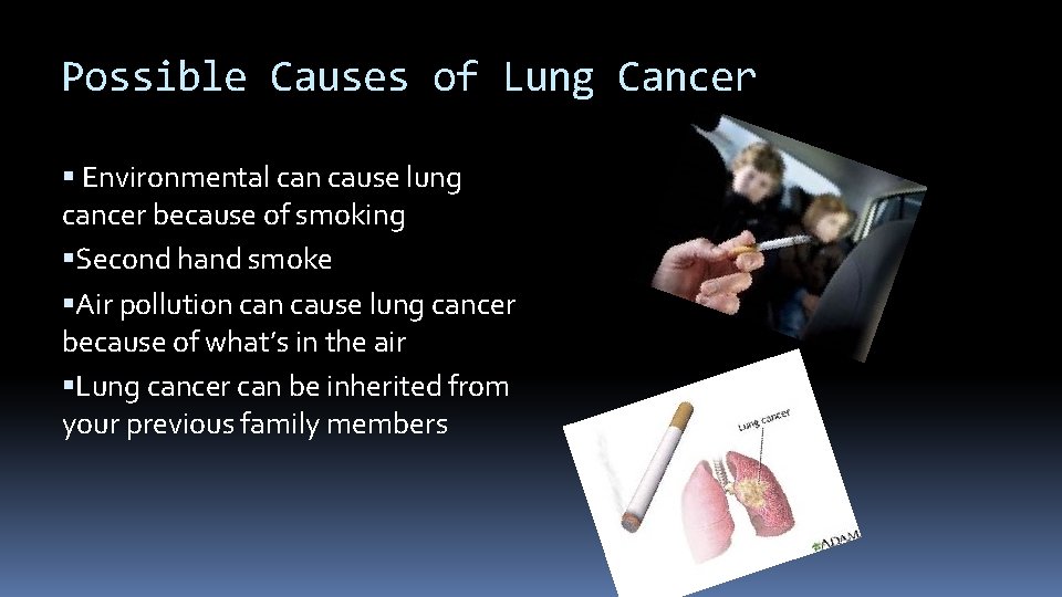 Possible Causes of Lung Cancer Environmental can cause lung cancer because of smoking Second