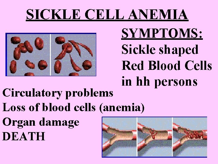 SICKLE CELL ANEMIA SYMPTOMS: Sickle shaped Red Blood Cells in hh persons Circulatory problems SICKLE CELL ANEMIA SYMPTOMS: Sickle shaped Red Blood Cells in hh persons Circulatory problems