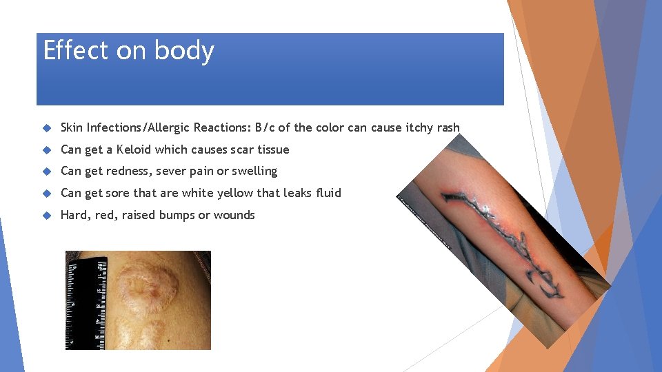 Effect on body Skin Infections/Allergic Reactions: B/c of the color can cause itchy rash