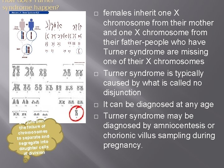 How does Turner syndrome happen? � � � Dis junction: the failure of chromosomes